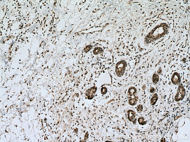 UBE2D1/2/3/4 Antibody in Immunohistochemistry (Paraffin) (IHC (P))