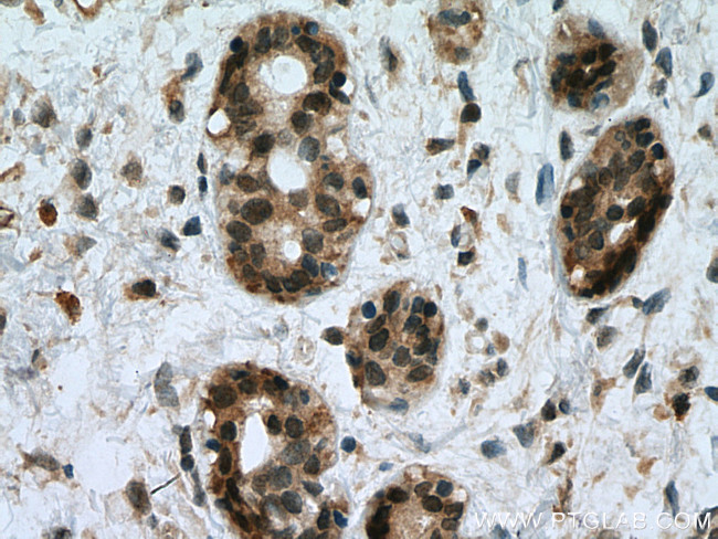 UBE2D1/2/3/4 Antibody in Immunohistochemistry (Paraffin) (IHC (P))