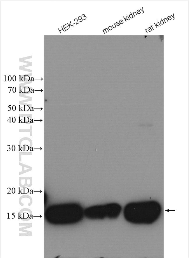 UBE2D1/2/3/4 Antibody in Western Blot (WB)