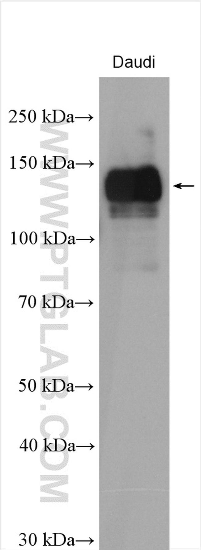 IL-4R Antibody in Western Blot (WB)