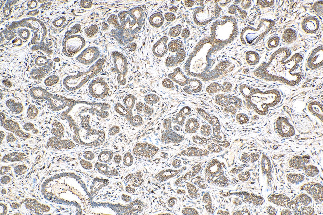 EEA1 Antibody in Immunohistochemistry (Paraffin) (IHC (P))