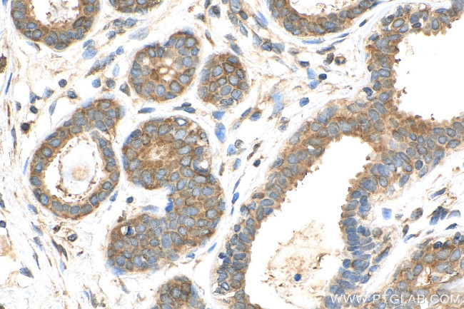 EEA1 Antibody in Immunohistochemistry (Paraffin) (IHC (P))