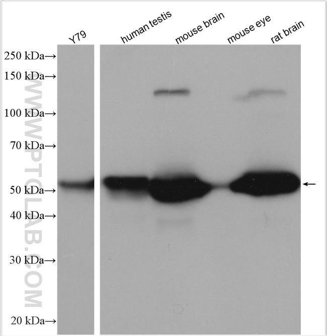 PRKAR2B Antibody in Western Blot (WB)