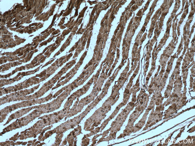 Caveolin-3 Antibody in Immunohistochemistry (Paraffin) (IHC (P))