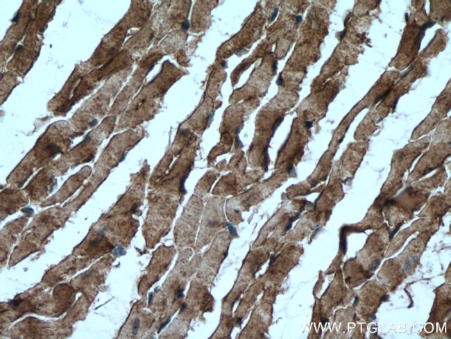 Caveolin-3 Antibody in Immunohistochemistry (Paraffin) (IHC (P))