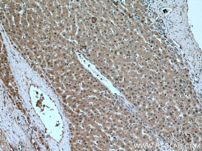 MAEA Antibody in Immunohistochemistry (Paraffin) (IHC (P))