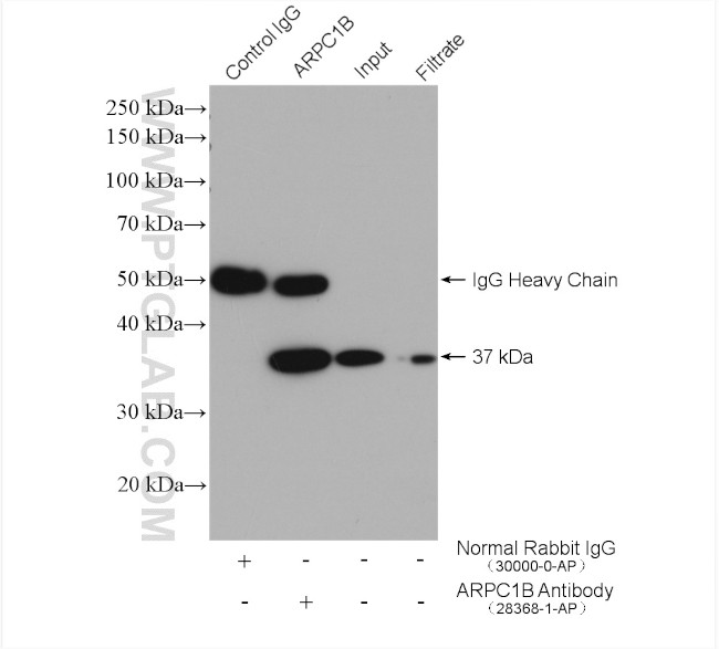 ARPC1B Antibody in Immunoprecipitation (IP)