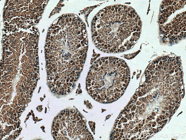 KIF2C Antibody in Immunohistochemistry (Paraffin) (IHC (P))