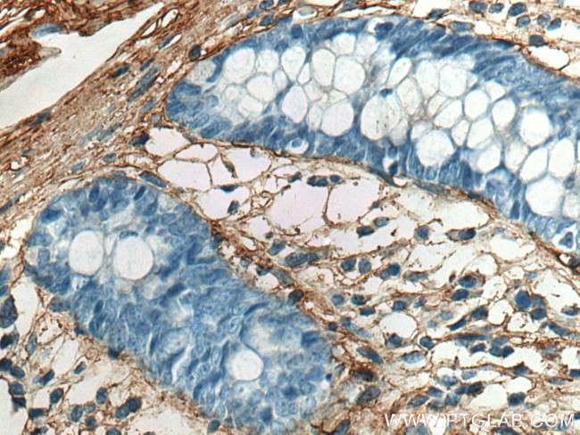 Collagen Type V Antibody in Immunohistochemistry (Paraffin) (IHC (P))