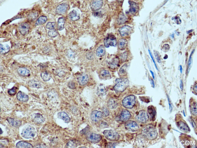 UPF1 Antibody in Immunohistochemistry (Paraffin) (IHC (P))