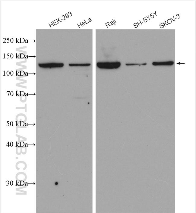 UPF1 Antibody in Western Blot (WB)