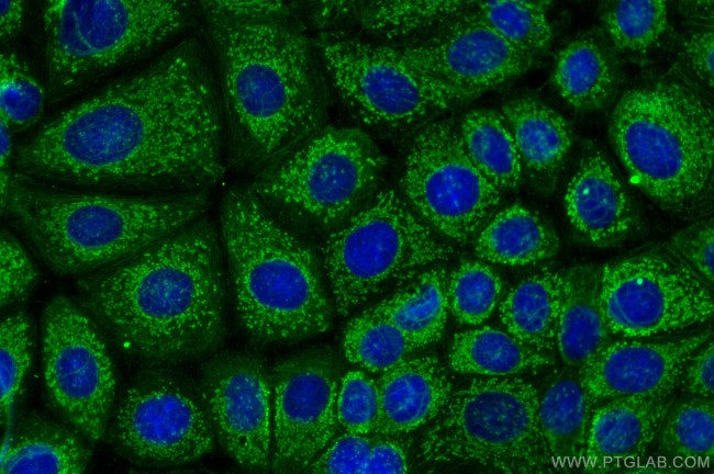 Beta TRCP Antibody in Immunocytochemistry (ICC/IF)