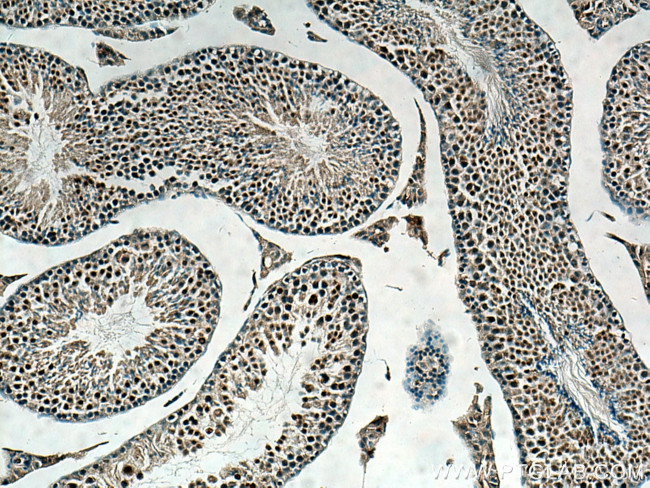 Beta TRCP Antibody in Immunohistochemistry (Paraffin) (IHC (P))