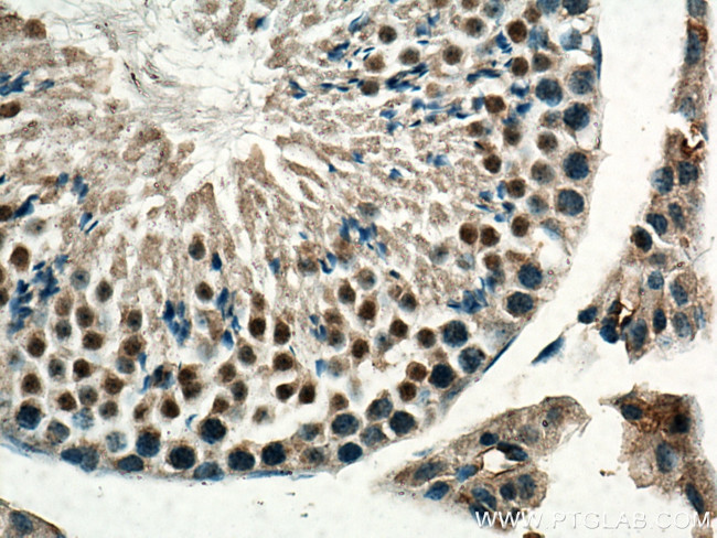 Beta TRCP Antibody in Immunohistochemistry (Paraffin) (IHC (P))