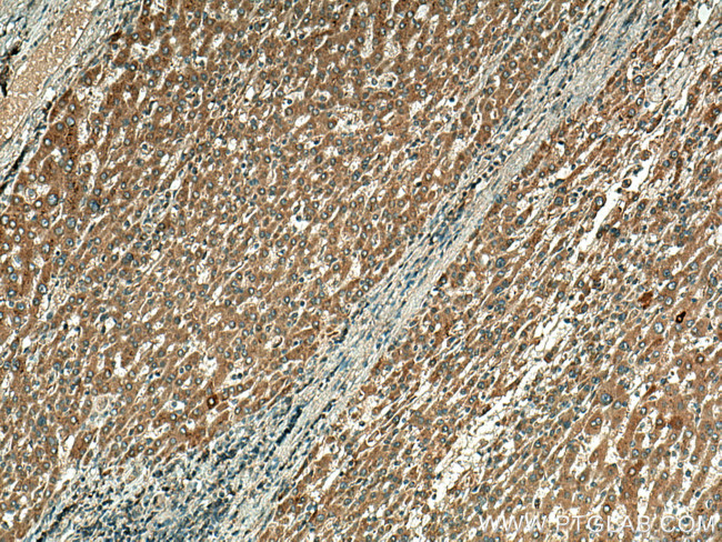 TBK1 Antibody in Immunohistochemistry (Paraffin) (IHC (P))