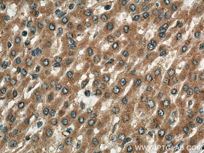 TBK1 Antibody in Immunohistochemistry (Paraffin) (IHC (P))