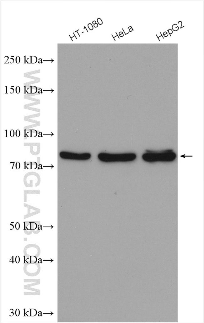 TBK1 Antibody in Western Blot (WB)