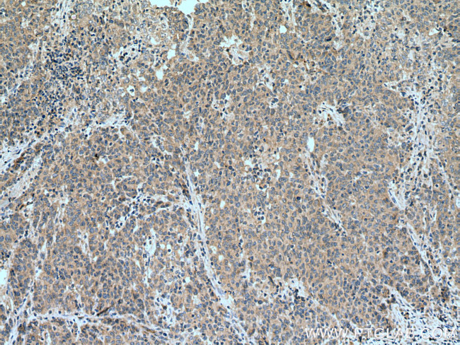 SEMA4C Antibody in Immunohistochemistry (Paraffin) (IHC (P))