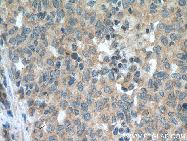 SEMA4C Antibody in Immunohistochemistry (Paraffin) (IHC (P))