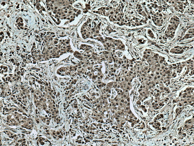 CUL1 Antibody in Immunohistochemistry (Paraffin) (IHC (P))