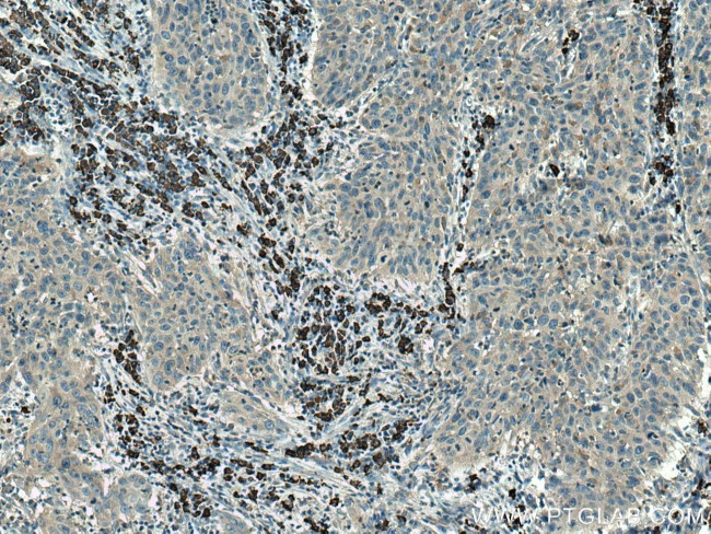 ATG7 Antibody in Immunohistochemistry (Paraffin) (IHC (P))