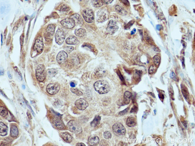 FBXW7 Antibody in Immunohistochemistry (Paraffin) (IHC (P))