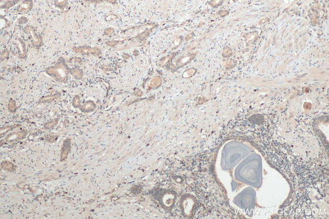 TGF beta 2 Antibody in Immunohistochemistry (Paraffin) (IHC (P))