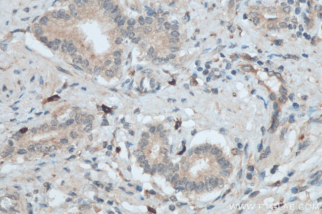 TGF beta 2 Antibody in Immunohistochemistry (Paraffin) (IHC (P))