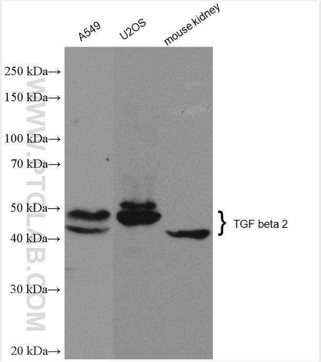 TGF beta 2 Antibody in Western Blot (WB)