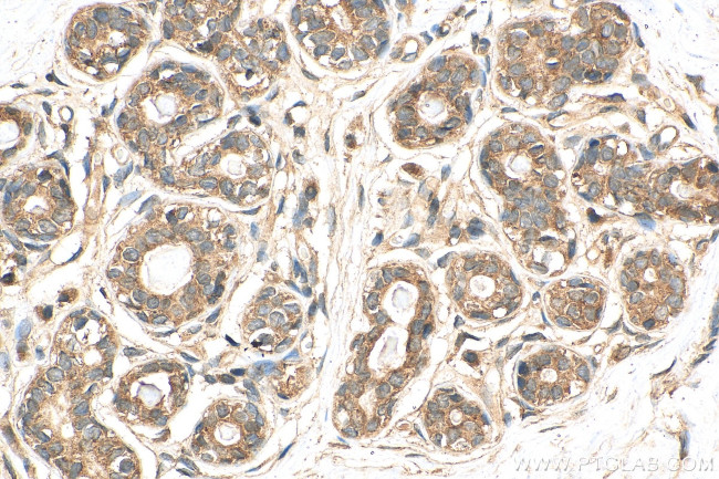 PGAM5 Antibody in Immunohistochemistry (Paraffin) (IHC (P))