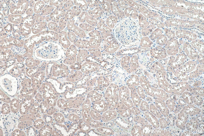 NCX1 Antibody in Immunohistochemistry (Paraffin) (IHC (P))