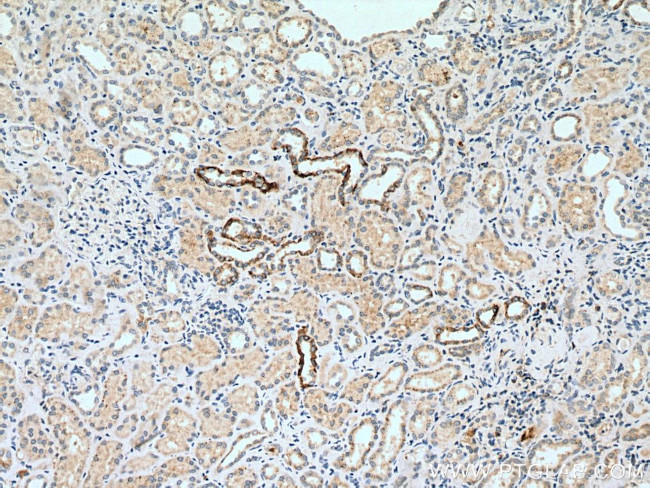 NCX1 Antibody in Immunohistochemistry (Paraffin) (IHC (P))