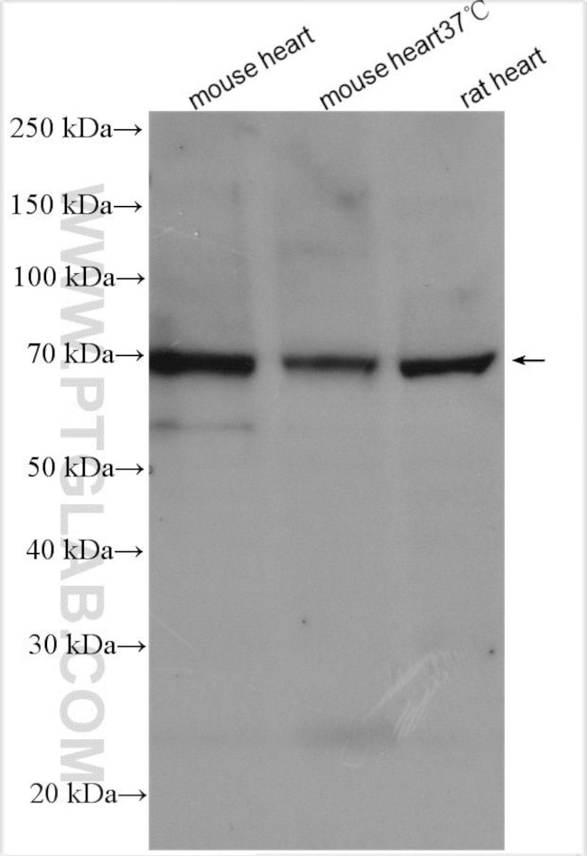 NCX1 Antibody in Western Blot (WB)