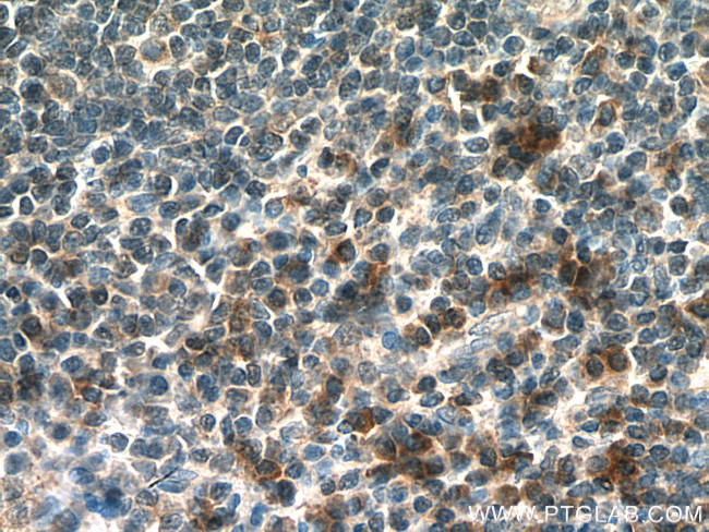 IL-15 Antibody in Immunohistochemistry (Paraffin) (IHC (P))