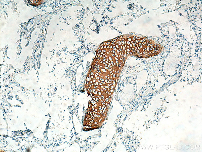 Collagen Type II Antibody in Immunohistochemistry (Paraffin) (IHC (P))