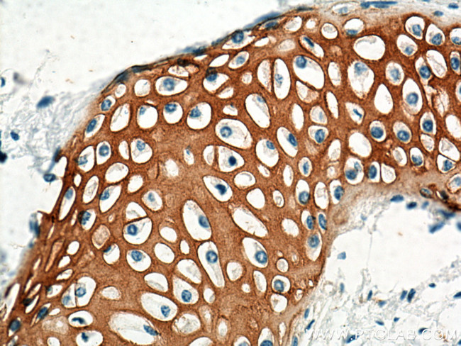 Collagen Type II Antibody in Immunohistochemistry (Paraffin) (IHC (P))