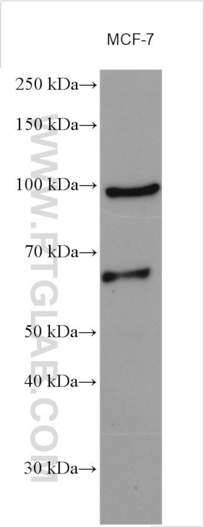 PHF17 Antibody in Western Blot (WB)