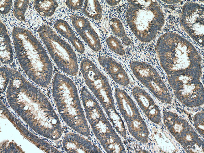 CARD11 Antibody in Immunohistochemistry (Paraffin) (IHC (P))