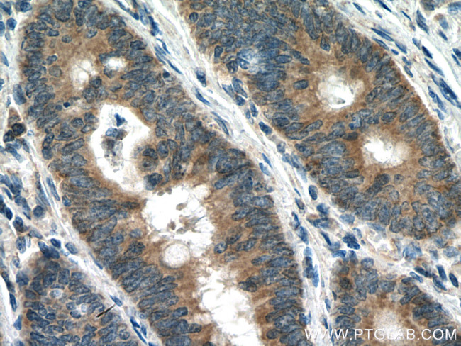 CARD11 Antibody in Immunohistochemistry (Paraffin) (IHC (P))