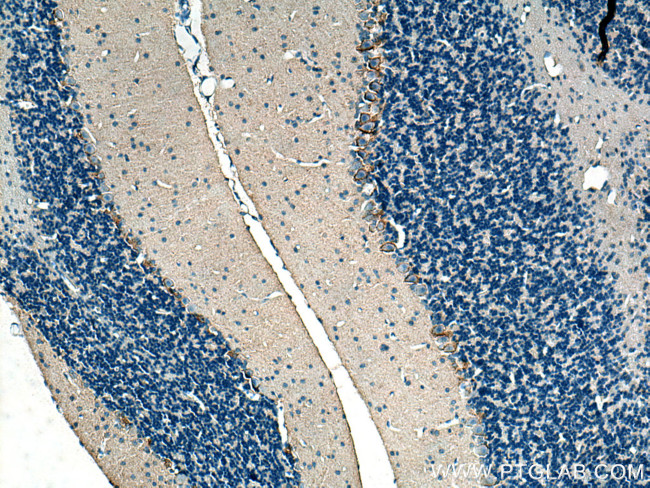 GAT1 Antibody in Immunohistochemistry (Paraffin) (IHC (P))