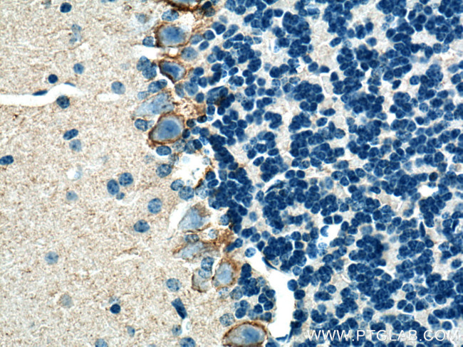 GAT1 Antibody in Immunohistochemistry (Paraffin) (IHC (P))