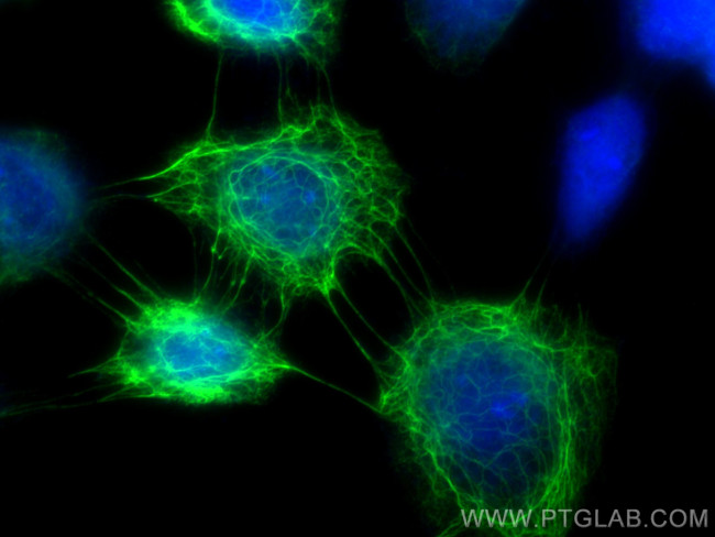 Cytokeratin 5 Antibody in Immunocytochemistry (ICC/IF)