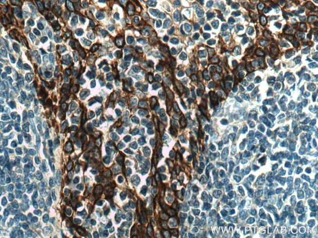 Cytokeratin 5 Antibody in Immunohistochemistry (Paraffin) (IHC (P))