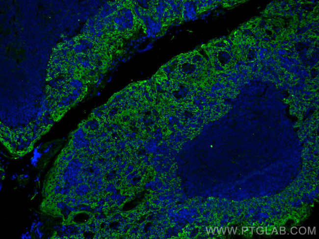 Cytokeratin 5 Antibody in Immunohistochemistry (PFA fixed) (IHC (PFA))