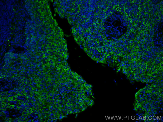 Cytokeratin 5 Antibody in Immunohistochemistry (PFA fixed) (IHC (PFA))