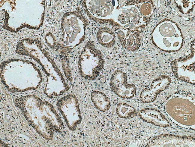 NOC2L Antibody in Immunohistochemistry (Paraffin) (IHC (P))