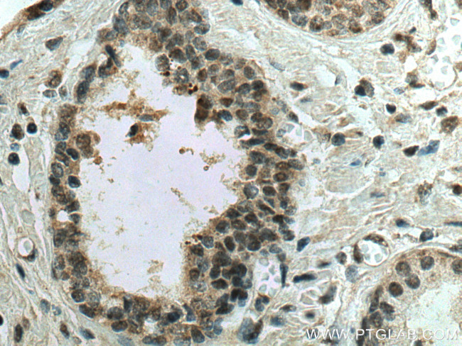 NOC2L Antibody in Immunohistochemistry (Paraffin) (IHC (P))