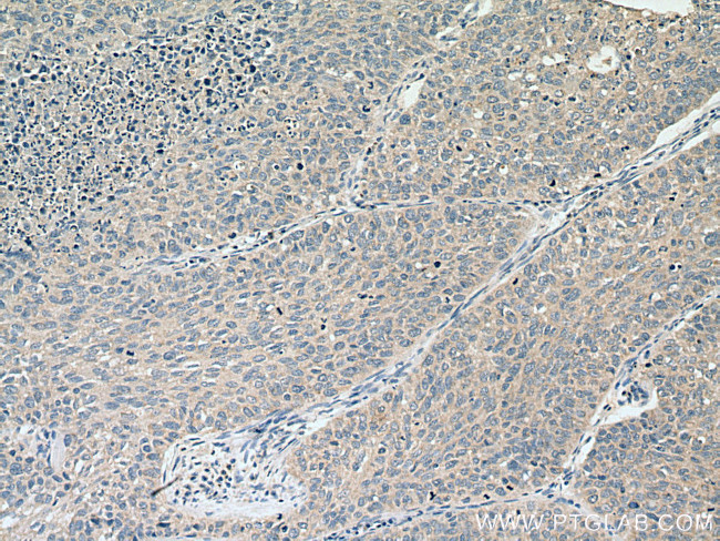 PIEZO1 (extracellular domain) Antibody in Immunohistochemistry (Paraffin) (IHC (P))