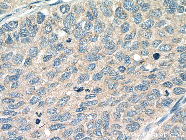 PIEZO1 (extracellular domain) Antibody in Immunohistochemistry (Paraffin) (IHC (P))