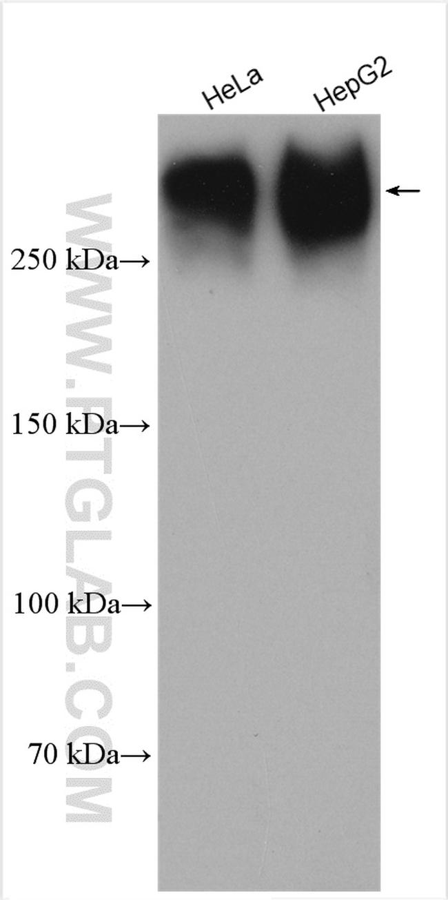 PIEZO1 (extracellular domain) Antibody in Western Blot (WB)